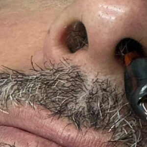 depilacion facial hombre